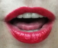 Death by a Kiss
